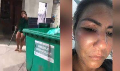Motorista de app diz que passageira a agrediu após não pagar corrida no RJ