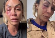 Vídeo: ativista trans é agredida por homem em condomínio de São Paulo