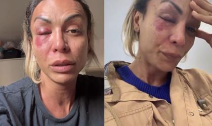 Vídeo: ativista trans é agredida por homem em condomínio de São Paulo