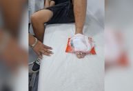 Vento derruba pedestal e atinge turista chileno no Cristo Redentor (RJ)