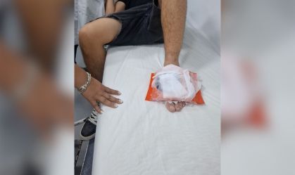 Vento derruba pedestal e atinge turista chileno no Cristo Redentor (RJ)