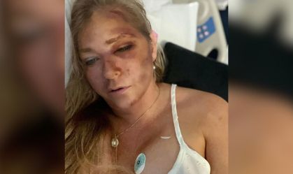 Mulher que acusou príncipe Andrew sofre acidente com ônibus escolar