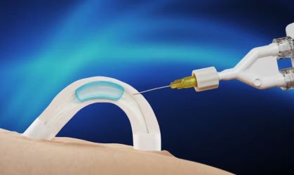 Contraceptivo masculino por implante avança em testes na Austrália