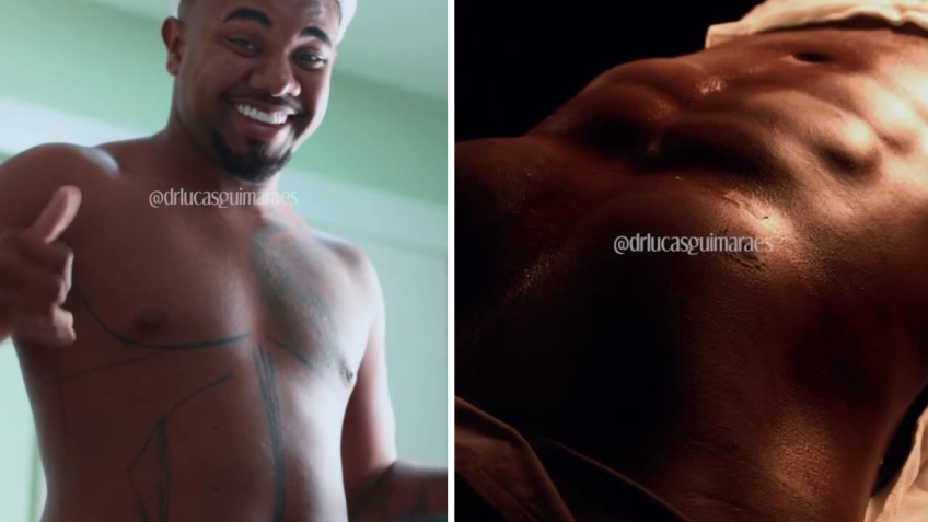 Davi Brito mostrou imagens antes e depois da cirurgia de lipoaspiração • Instagram/Davi Brito