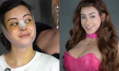 Influencer relata processo de transição: "Me despeço do Zé Longuinho"