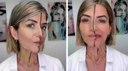 Bita Farrell publicou vídeo em que fala da aplicação de botox em apenas um lado do rosto