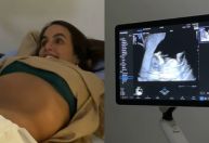 Grávida de Thiaguinho, Carol Peixinho mostra ultrassom; confira
