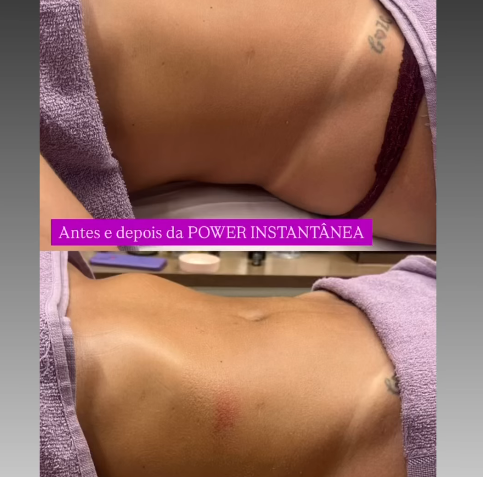 Em story publicado no Instagram, Graciele Lacerda exibiu como está sua barriga três meses após o nascimento de Clara, sua filha com Zezé Di Camargo • Instagram/Graciele Lacerda