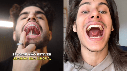 Mewing é uma tática muito difundida no TikTok que promete definir a mandíbula