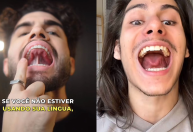 Mewing define a mandíbula? Conheça riscos do exercício viral do TikTok