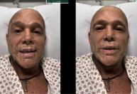 Com câncer, Netinho informa previsão de alta após 2ª fase da quimioterapia