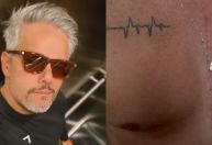 Otaviano Costa mostra cicatriz de cirurgia: "Símbolo de renascimento"