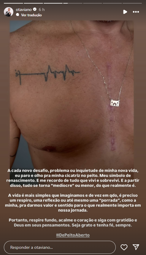 Otaviano Costa mostrou cicatriz no peito nesta quarta (9) • Instagram/Otaviano Costa