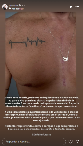 Otaviano Costa mostrou cicatriz no peito nesta quarta (9) • Instagram/Otaviano Costa