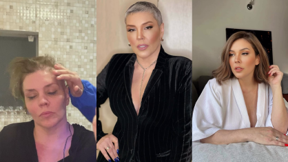 Artista apontou que sua cicatriz que a lembra do sucesso de seu tratamento do câncer