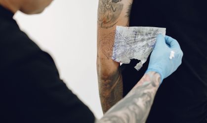 "Quero minha pele de volta": por que as pessoas estão removendo tatuagens?