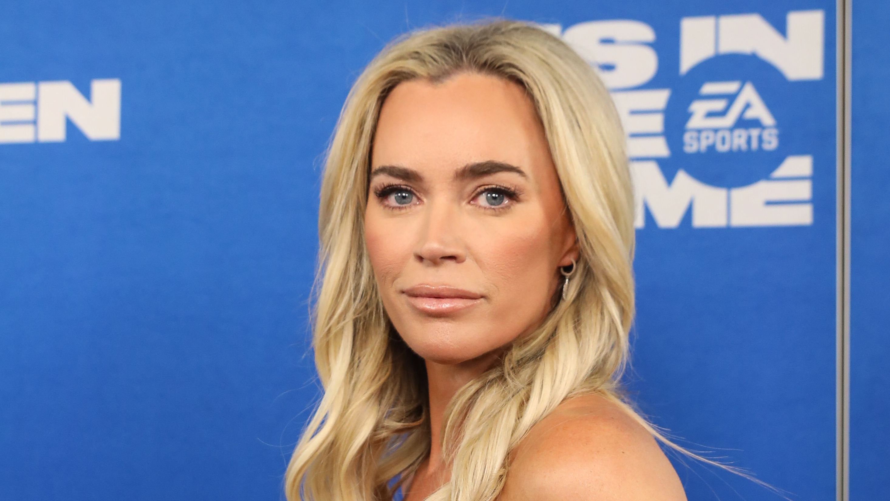 Teddi Mellencamp tem melanoma no estágio 4