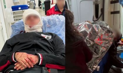 Vítimas de queda de placa no Morumbis passam por cirurgia na cabeça em SP