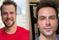 Ex-BBB Gustavo mostra transformação após procedimento: "Nem me reconheci"