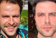 Ex-BBB Gustavo celebra harmonização facial: "Ainda não acabou"