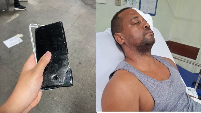Celular atingiu rosto do motorista • Reprodução/Arquivo Pessoal