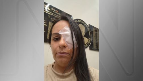 A pedagoga Errta Rianny Mendes teve problemas após passar por mutirão oftalmológico