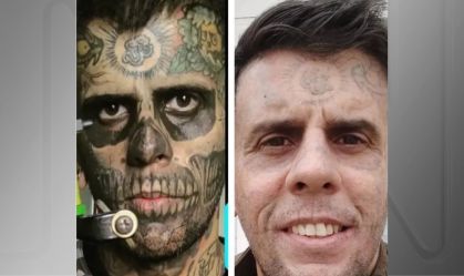 “Homem mais tatuado do Brasil” mostra rosto após sessão de remoção a laser