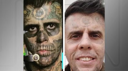 Antes e depois do rosto do homem que era considerado o mais tatuado do Brasil