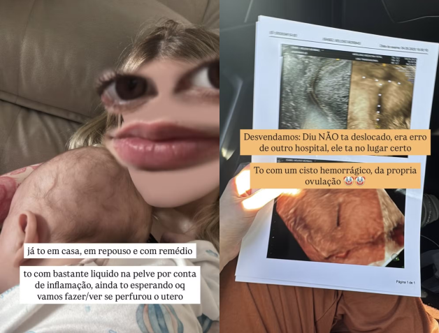 Isabel Veloso revelou detalhes do cisto hemorrágico que a afastou das redes sociais • Instagram/Isabel Veloso