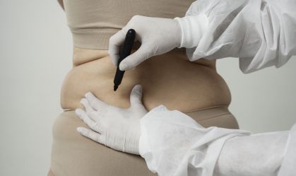 Bariátrica auxilia adolescentes que não respondem a tratamentos, diz médico