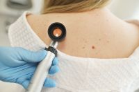 83% dos melanomas no mundo são causados por raios ultravioleta, diz OMS