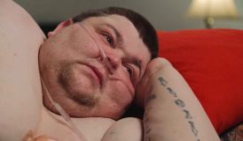 "Quilos Mortais": como está Cillas, que não saía da cama por ter 330 kg