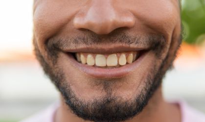 7 alimentos e hábitos que escurecem os dentes