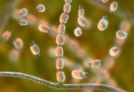 Infecções por superfungos preocupam especialistas e desafiam tratamentos