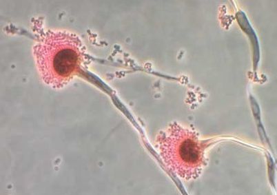 Aspergillus, um tipo de fungo, está expandindo seu alcance à medida que o mundo esquenta, de acordo com uma nova pesquisa
