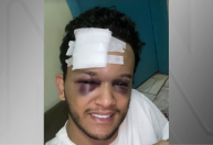 Cantor de dupla sertaneja sofre grave acidente após show: “Que pancada”