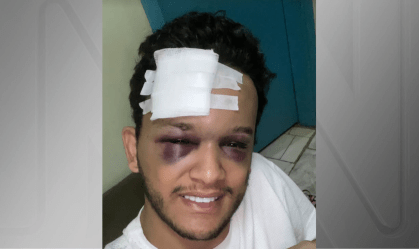 Cantor de dupla sertaneja sofre grave acidente após show: “Que pancada”