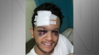 Cantor de dupla sertaneja sofre grave acidente após show: “Que pancada”