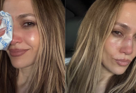 Jennifer Lopez se machuca e precisa de pontos após ensaio de premiação