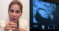 Maíra Cardi admite medo ao explicar riscos da gravidez: "Angústia"