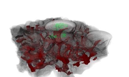 Dentes humanos podem ter origem em estruturas sensoriais de peixes antigos