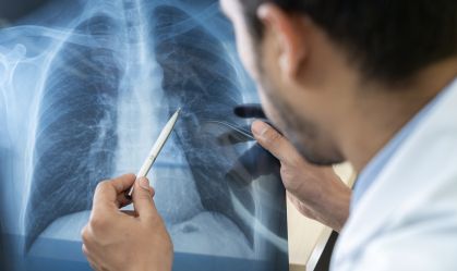 Entenda o que é pneumonia silenciosa, que tem alertado autoridades de saúde