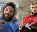 Ator de "Harry Potter" passa por cirurgia respiratória de emergência
