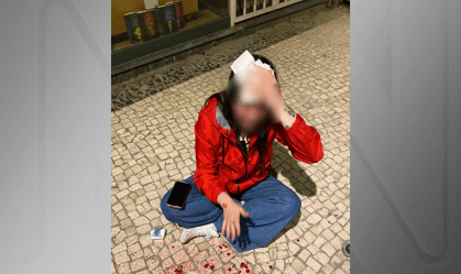 Brasileira leva pedrada na cabeça em Portugal