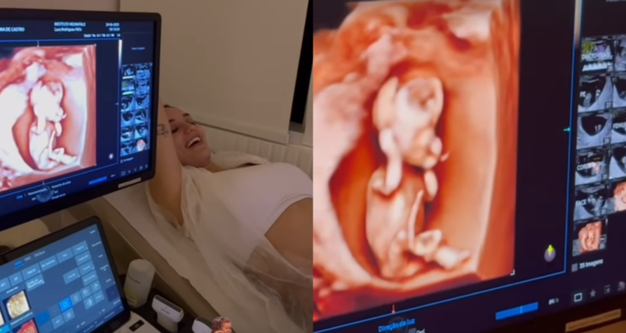 Rafa Kalimann durante exame de ultrassom que mostra a pequena Zuza • Instagram/Nattanzinho
