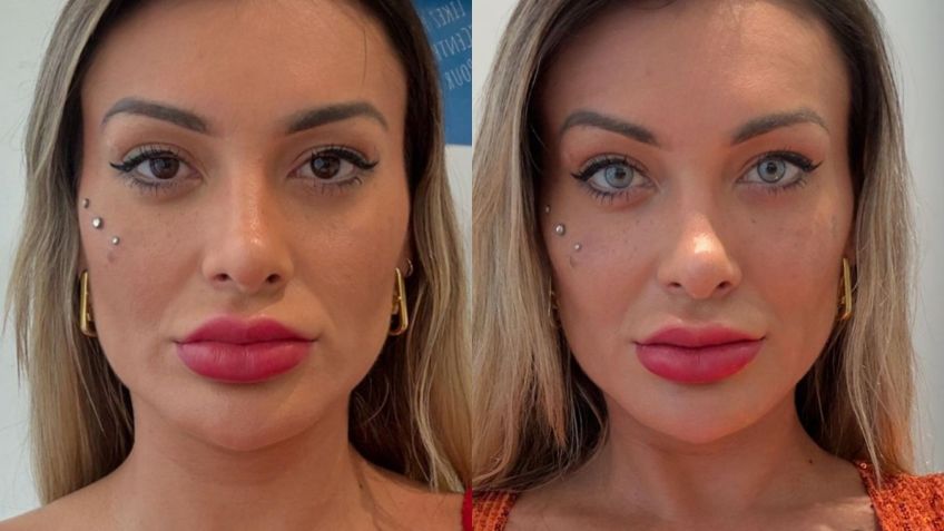 Antes e depois de Andressa Urach • Instagram/Andressa Urach