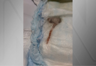 Mulher encontra rato dentro de fralda de seu filho no RJ