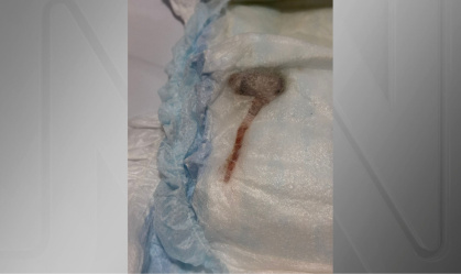 Mulher encontra rato dentro de fralda de seu filho no RJ