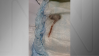 Mulher encontra rato dentro de fralda de seu filho no RJ