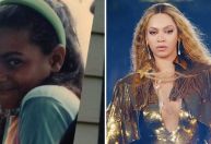 Beyoncé recorda jornada vivendo com psoríase desde a infância; assista